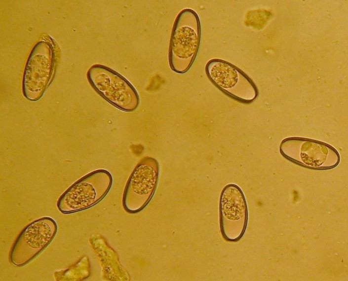 Kokzidien unter dem Mikroskop (Foto VPL ‚Der Wald‘) Wurmbekämpfung