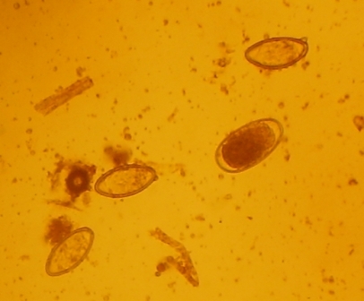 Strongylus und Anuswürmer Eier